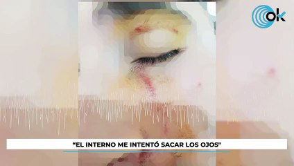 Entrevista tras un brutal ataque a un funcionario de prisiones: "El interno me intentó sacar los ojos"