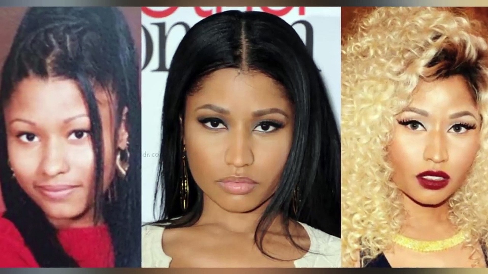 Nicki Minaj Plastic Surgery - A Complete History