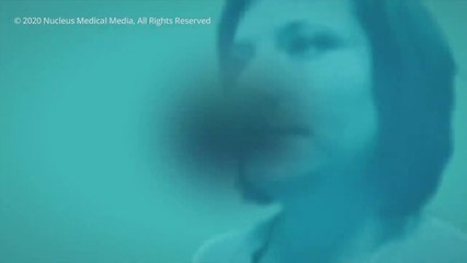 COVID-19 Animation_ What Happens If You Get Coronavirus_