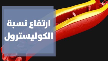 ارتفاع نسبة الكوليسترول والدهون الثلاثية