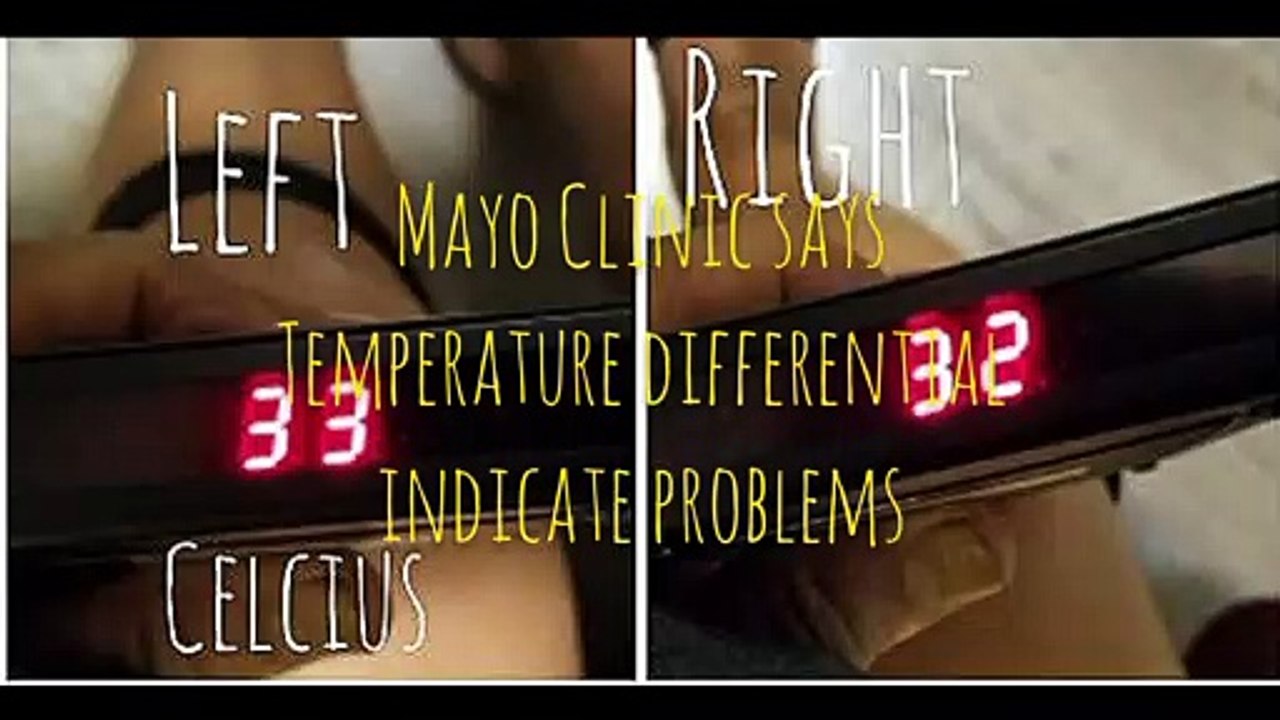 11 miraculous acupuncture points, ancient Chinese traditional medicine, for swollen knee, test by Bobby the Magician, Vancouver, and, electric wheelchair repairs, Richmond BC, review