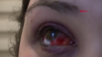 KARABÜK Genç kadını darbetti; sabah 'Pide yaptırayım mı' diye mesaj attı