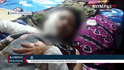 Siswi SMK Disiram Air Keras Oleh Orang Tak Dikenal