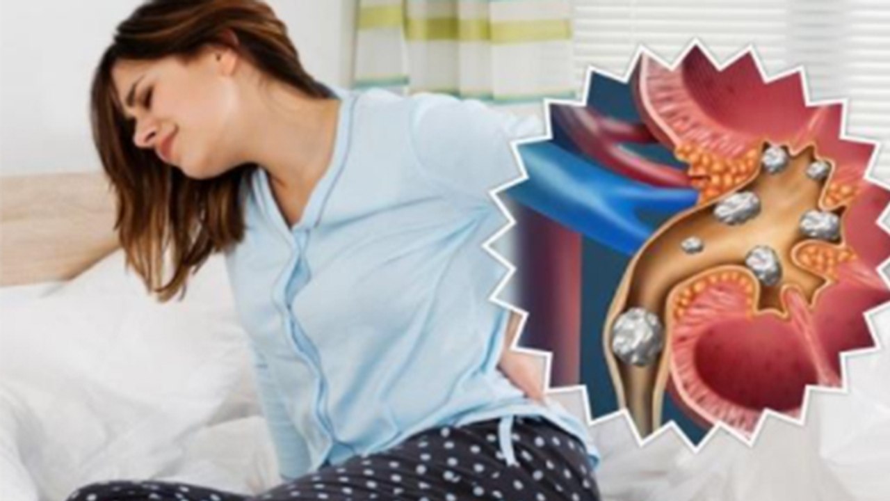 पथरी को जड़ से खत्म करेगा ये चीज |  Kidney Stone treatment । Boldsky