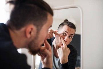 Prevent Acne With These Easy Tips