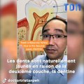 Un dentiste nous explique pourquoi nous avons les dents jaunes !