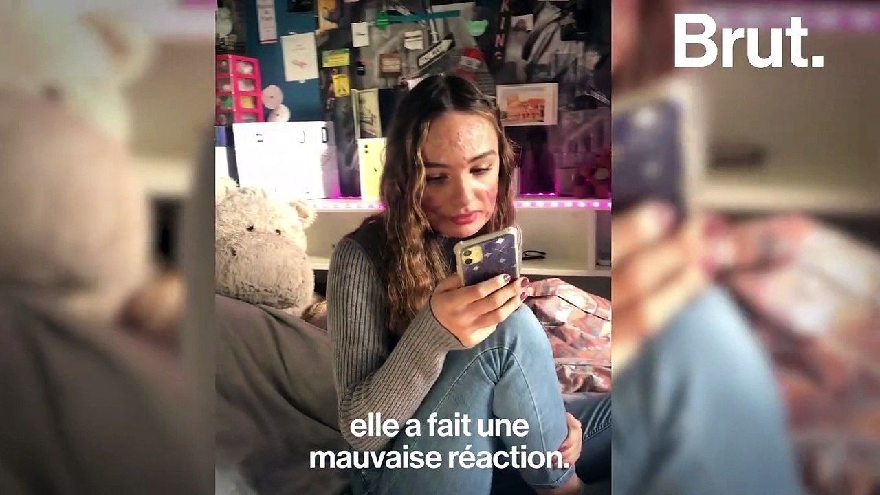 Le témoignage de Mattéa, victime d'acné sévère