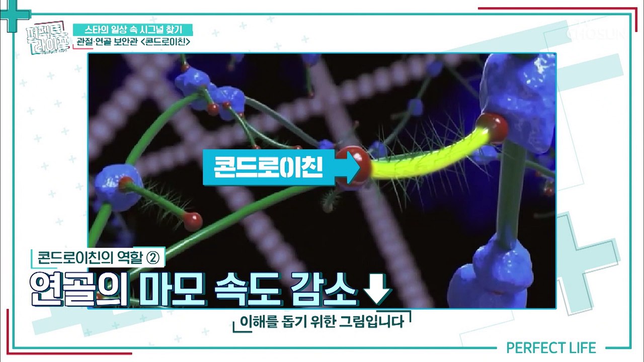 연골 & 관절 보안관 관절 건강에 좋은 ◆콘드로이친◆ TV CHOSUN 2021032...