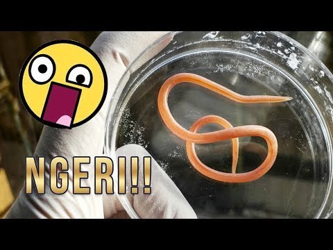 5 HEWAN YANG BISA HIDUP DI DALAM TUBUH MANUSIA