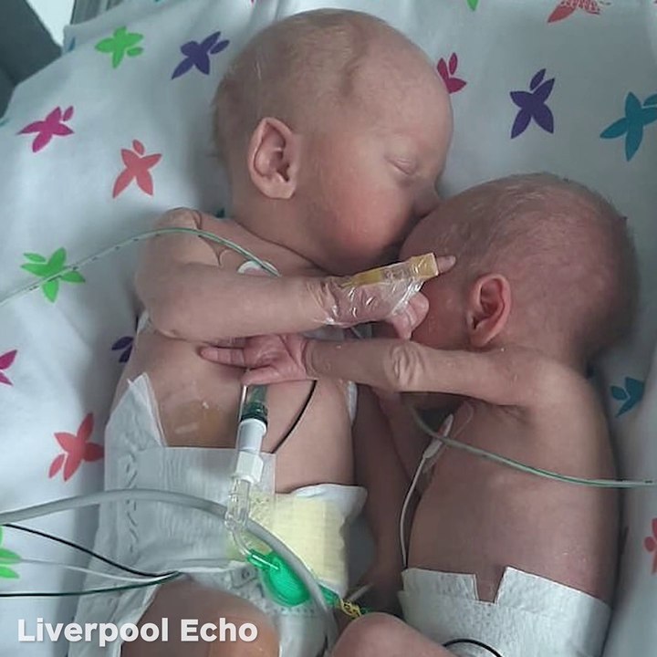 Après avoir été séparée à la naissance, ce bébé prématuré câline son frère jumeau pour la première fois !