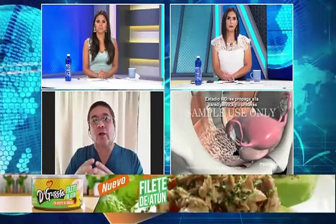 Sepa cómo detectar a tiempo el cáncer de cuello uterino