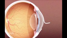 عملية الليزر للعينين (LASIK)