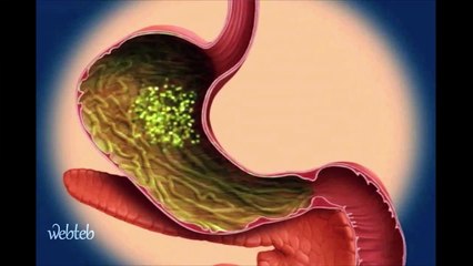 كيف يؤثر السكري على مستوى السكر في الدم؟