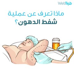 عملية شفط الدهون
