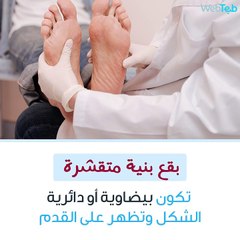 4 أمور غريبة تصيب بشرتك نتيجة الإصابة بالسكري