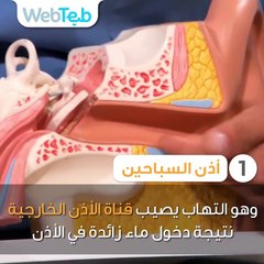 4 أمراض قد تصاب بها بسبب برك السباحة
