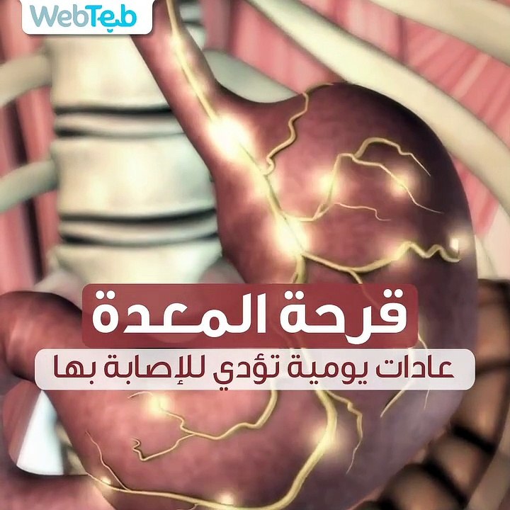 قرحة المعدة: عادات يومية تؤدي إلى الإصابة بها