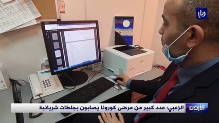 الزعبي عدد كبير من مرضى كورونا يصابون بجلطات شريانية