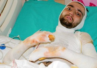 Sobaya benzin dökünce yanan Salih Cehennemi yaşadım