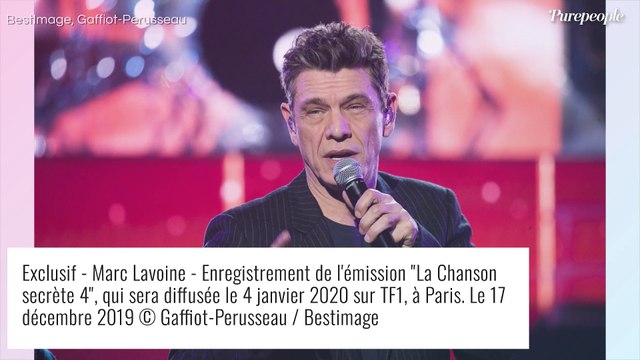 Marc Lavoine prêt pour la chirurgie esthétique ? Je sais que tout va tomber...