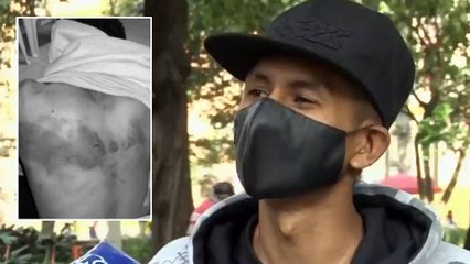 "Pensé que me iban a matar": joven golpeado por policías en Medellín