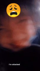 Help! My Chubby Cousin Attacked Me 😱