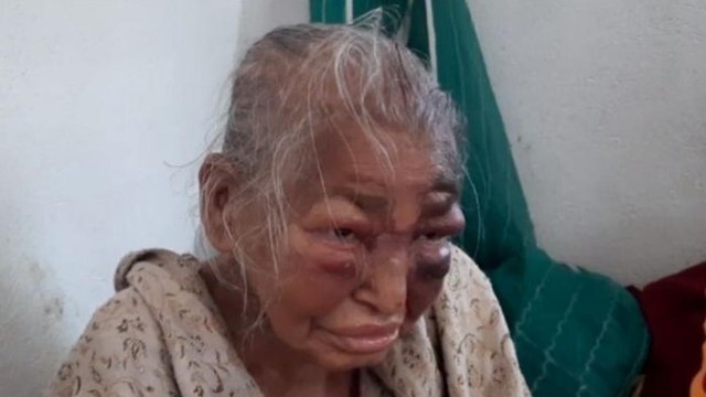 Elderly BJP women leader died, Politics intesified in Bengal