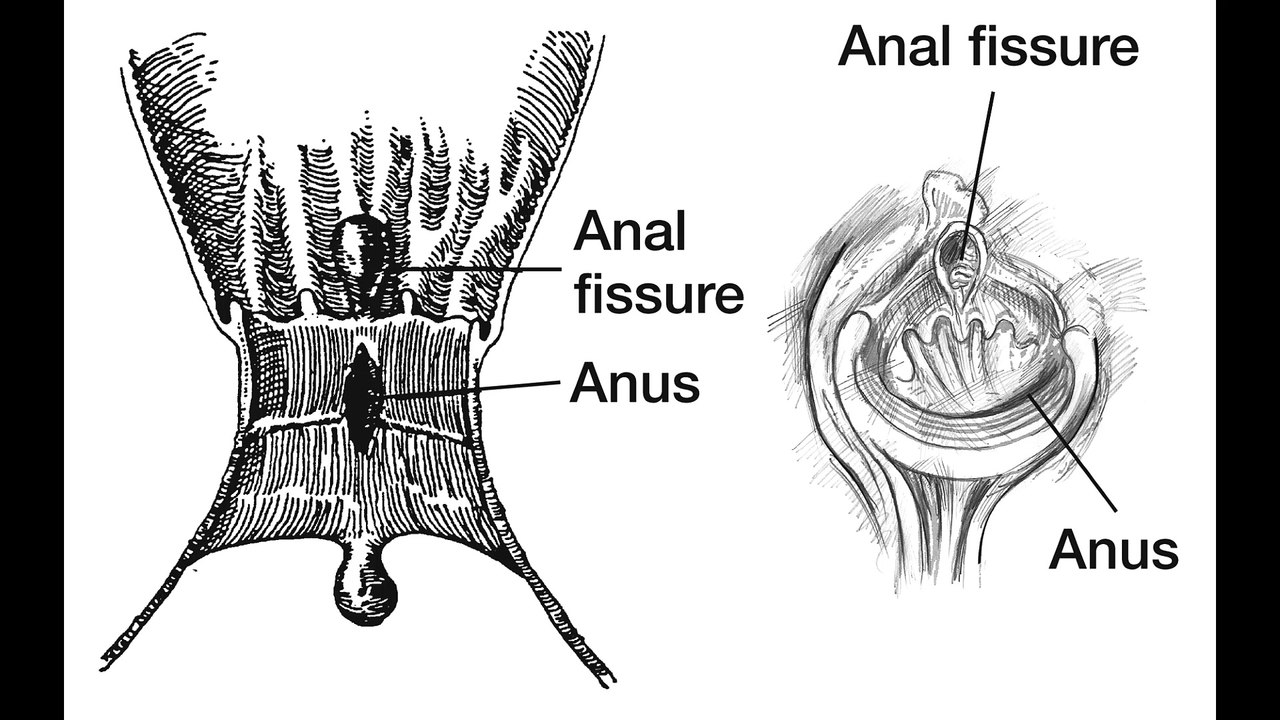 Anus (Healing Frequency)