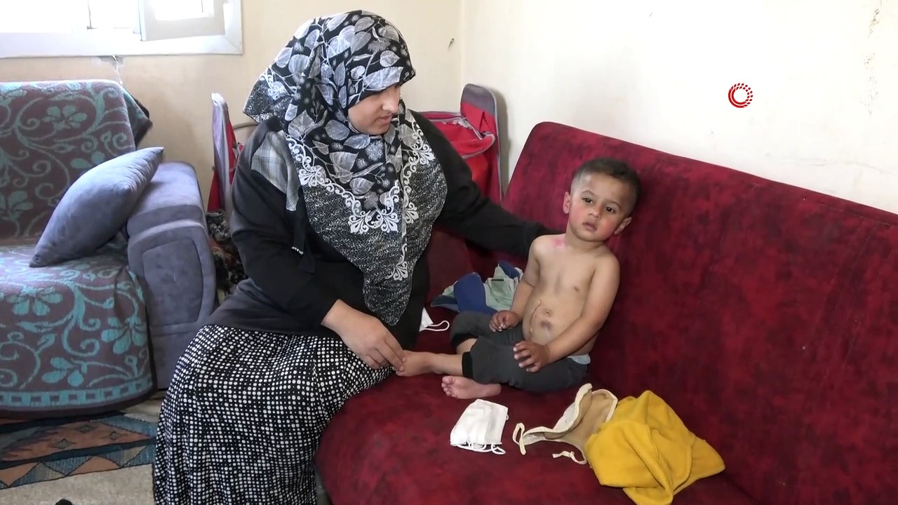 Yemek borusu olmayan Muhammed yardım bekliyor