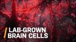 Can Skin Cells Turn Into Brain Cells? Scientists Tried It