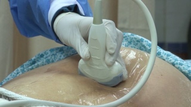 Perú registró en 2020 cifras trágicas en los niveles de mortalidad materna