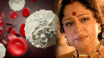 Kirron Kher को हुआ Multiple Myeloma Cancer ! मल्टीपल मायलोमा कैंसर जानें  कारण, लक्षण और उपाय