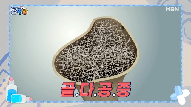 알약방 40회 [작은 충격에도 骨(골) 骨(골)! 중년 여성들의 뼈 건강을 위협하는 골다공증!]