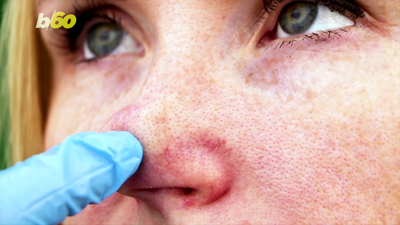 Myth Busting Your Poreless Skin Potential
