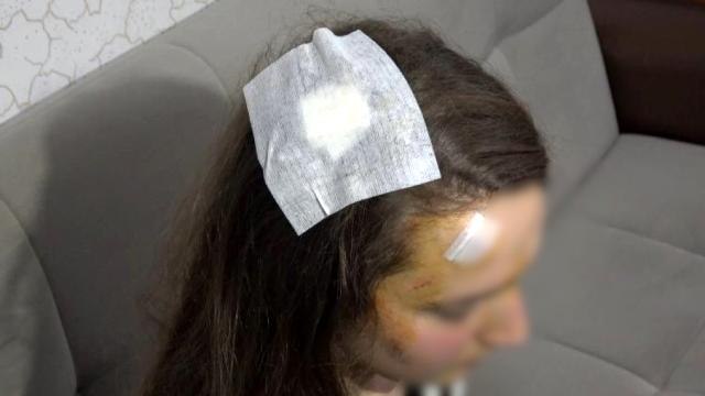 Genç kız, tanımadığı kişi tarafından sokak ortasında 'Muşta' ile darp edildi