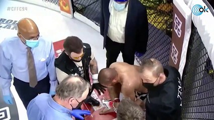 Un luchador de MMA pierde un dedo en una pelea