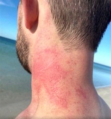 - Avustralya'da yer bilimciye ahtapot saldırısı