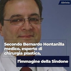 A chi appartiene l’immagine della Sindone