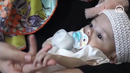 ‘Türkiye'de en düşük ağırlıklı karaciğer naklini gerçekleştirdik’