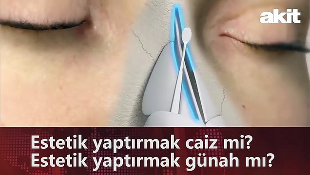 Estetik yaptırmak caiz mi? Estetik yaptırmak günah mı?