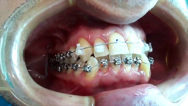 10 INVENTOS DE LA NASA QUE NOS HAN CAMBIADO LA VIDA