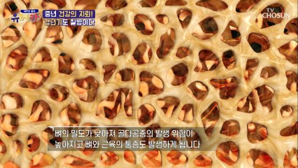 완경 이후 갱년기가 오면서 바뀌는 신체적 변화는? TV CHOSUN 20210403 방송