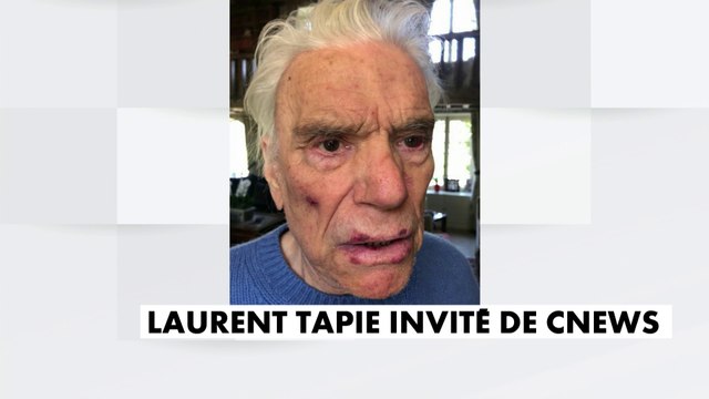 Pascal Praud dévoile des photos des blessures de Bernard et Dominique Tapie : Les visages abîmés témoignent de la brutalité de ces agresseurs
