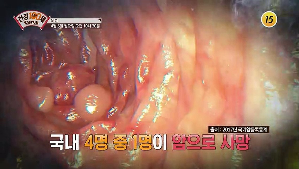 우리는 지금 콜레스테롤 비상사태!_명심보감 33회 예고 TV CHOSUN 210405 방송