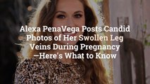 Alexa PenaVega Posts Candid Photos of Her Swollen Leg Veins During Pregnancy—Here’s What t