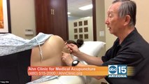 The Ahn Clinic treats severe asthma using medical acupuncture