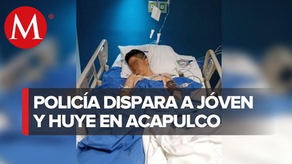 Joven en Acapulco Guerrero pierde la pierna a manos de la policía estatal