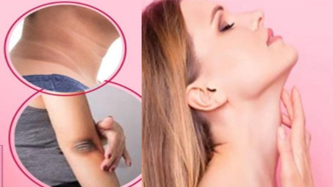 गर्दन, कोहनी और घुटनों का कालापन कैसे दूर करें |  Darkness Removal Home Remedy | Boldsky