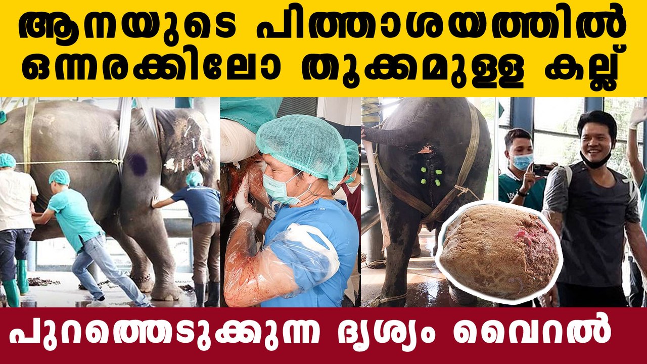 Removed large gallstone from elephant