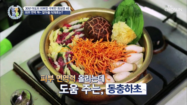 아토피 극복한 ‘피부 면역력’ 올리는 생활습관 ✓ TV CHOSUN 20210408 방송